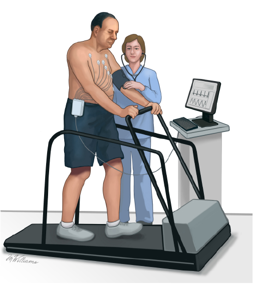 This drawing shows a person having a stress test. 